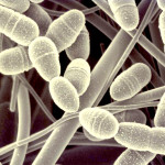 Туберкулез простаты — особенности болезни